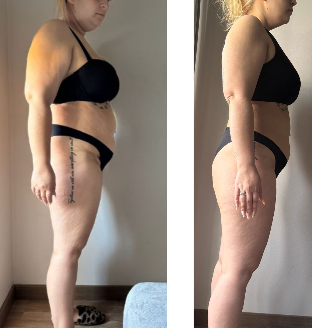 Transformação corporal feminina com foco em treino, nutrição personalizada e perda de peso saudável — Resultados reais para mulheres que querem emagrecer, tonificar e conquistar bem-estar físico e emocional.